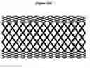 Fig. 16 - Methods and apparatus for endovascularly replacing a patient's heart valve