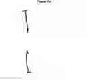 Fig. 19 - Methods and apparatus for endovascularly replacing a patient's heart valve