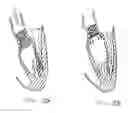 Fig. 22 - Methods and apparatus for endovascularly replacing a patient's heart valve