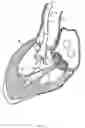 Fig. 07 - Methods and apparatus for endovascularly replacing a heart valve