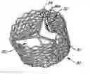 Fig. 01 - Methods and apparatus for endovascularly replacing a patient's heart valve
