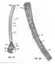 Fig. 03 - Methods and apparatus for endovascularly replacing a patient's heart valve