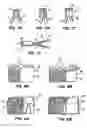 Fig. 13 - Methods and apparatus for endovascularly replacing a patient's heart valve