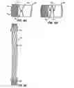 Fig. 14 - Methods and apparatus for endovascularly replacing a patient's heart valve