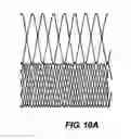 Fig. 15 - Methods and apparatus for endovascularly replacing a patient's heart valve