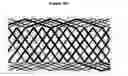 Fig. 17 - Methods and apparatus for endovascularly replacing a patient's heart valve