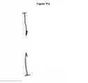 Fig. 19 - Methods and apparatus for endovascularly replacing a patient's heart valve