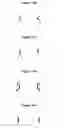 Fig. 20 - Methods and apparatus for endovascularly replacing a patient's heart valve
