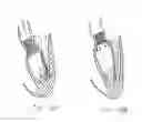 Fig. 22 - Methods and apparatus for endovascularly replacing a patient's heart valve