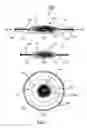 Fig. 06 - Accommodative intraocular lens