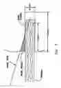 Fig. 06 - Method and apparatus for reconstructing a ligament