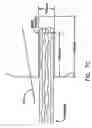 Fig. 09 - Method and apparatus for reconstructing a ligament