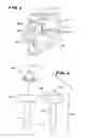 Fig. 02 - Facet arthroplasty devices and methods