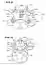 Fig. 06 - Facet arthroplasty devices and methods