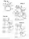 Fig. 08 - Facet arthroplasty devices and methods