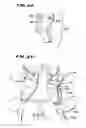 Fig. 10 - Facet arthroplasty devices and methods