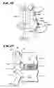 Fig. 12 - Facet arthroplasty devices and methods