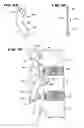 Fig. 14 - Facet arthroplasty devices and methods
