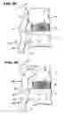 Fig. 15 - Facet arthroplasty devices and methods