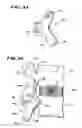 Fig. 16 - Facet arthroplasty devices and methods