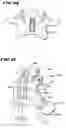 Fig. 09 - Facet arthroplasty devices and methods