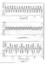 Fig. 04 - Time-scale modification of audio using separated frequency bands