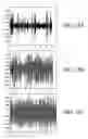 Fig. 13 - Summarization of football video content
