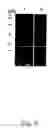 Fig. 07 - Isolated nucleic acids encoding xanthomonan polypeptides and uses thereof