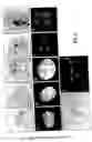 Fig. 07 - Male germ line cell-specific sequences