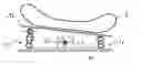 Fig. 01 - Patient positioning system for radiotherapy