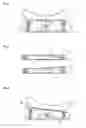 Fig. 04 - Patient positioning system for radiotherapy