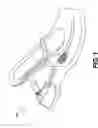 Fig. 02 - Devices and systems for dynamic foot support