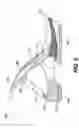 Fig. 06 - Devices and systems for dynamic foot support