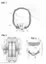 Fig. 02 - Jewelry assembly
