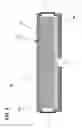 Fig. 06 - Filter constructions containing breather and recirculation filter elements
