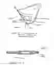 Fig. 07 - Respiratory mask with inserted spacer