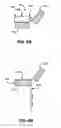 Fig. 09 - Hanging scaffold support