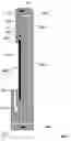 Fig. 02 - Electrophoretic separation system