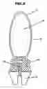 Fig. 03 - Safety tap handle