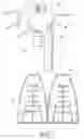 Fig. 02 - Method of discharging an aerosolized fluid