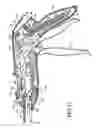 Fig. 16 - Closure plate lockout for a curved cutter stapler