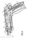 Fig. 17 - Closure plate lockout for a curved cutter stapler