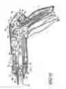 Fig. 17 - Knife retraction arm for a curved cutter stapler