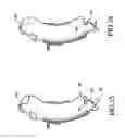 Fig. 24 - Knife retraction arm for a curved cutter stapler