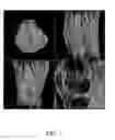 Fig. 02 - Test object for calibration of imaging measurements of mammalian skeletal joints