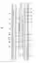 Fig. 02 - Lifetime pulsed neutron/chlorine combination logging tool