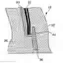 Fig. 01 - Plastics moulding