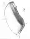 Fig. 02 - Plastics moulding