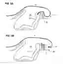 Fig. 06 - Wind deflector of open car