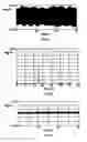 Fig. 04 - Process for determining a relative movement of two systems and a sensor therefor